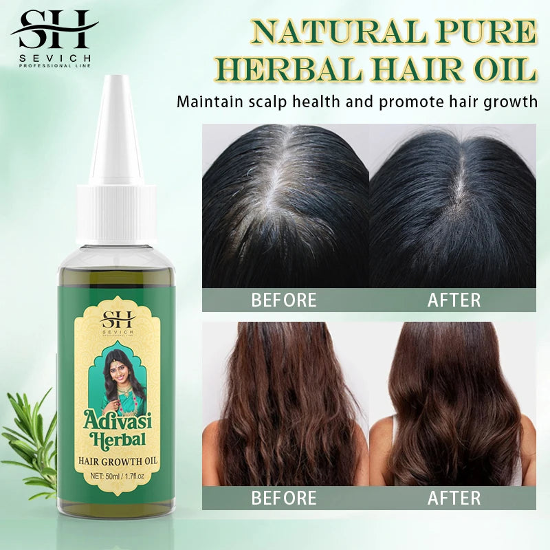 Ayurvedic Hair Growth Oil India Adivasi Organic Hair Growth Serum Anti Hair Loss Fast Regrowth Thicken Oils Hair Growth Products