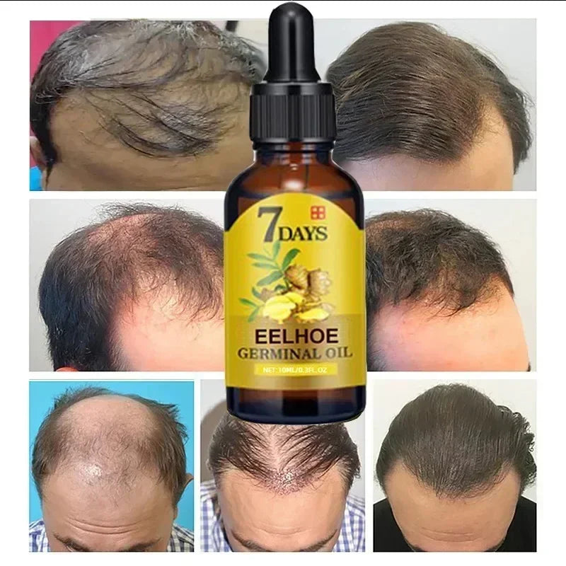 7 Day Rapid Growth Liquid Anti Hair Loss Ginger Growth Conditioning  Treatment Nourish Hair Growth Oil Scalp Care Serum Products