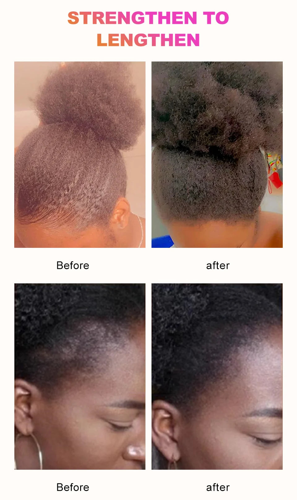 Sevich Chebe Hair Loss Treatment Spray Traction Alopecia Chebe Powder Essential Oil Africa Crazy Hair Growth Products Hair Care