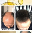 The most effective hair growth essential oil in 2024. Experts authoritatively certified,effective in repairing baldness and hair