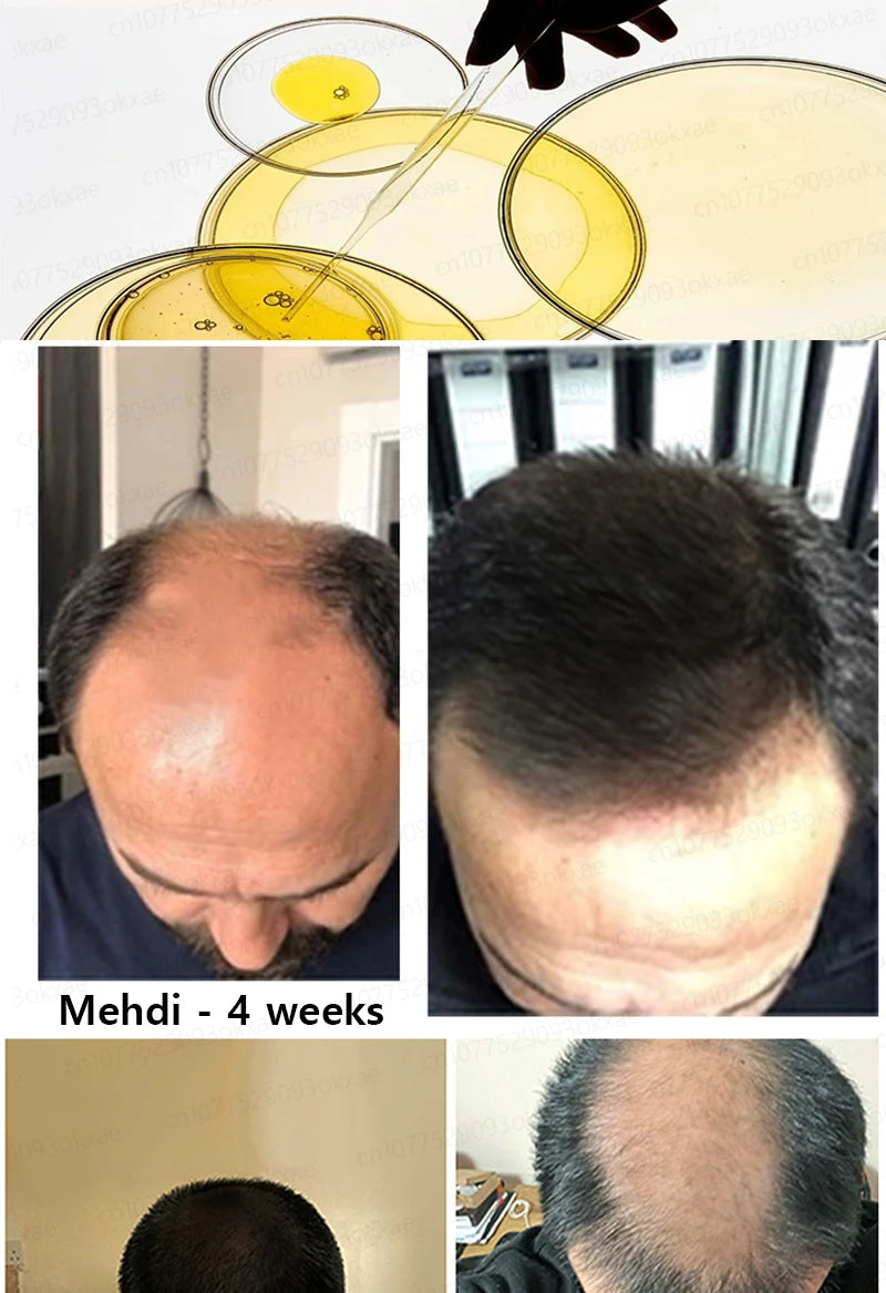 Hair growth essential oil, effectively repair baldness and hair loss, new hair growth