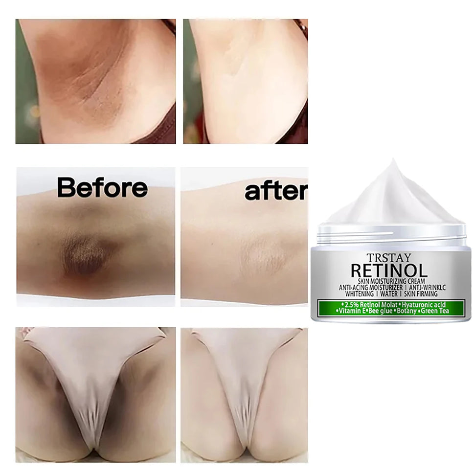 Whitening Cream Private Parts Whitening Bleaching Face Body Lightening Cream Underarm Armpit Whitening Cream Legs Knees