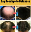 Hair growth essential oil, effectively repair baldness and hair loss, new hair growth