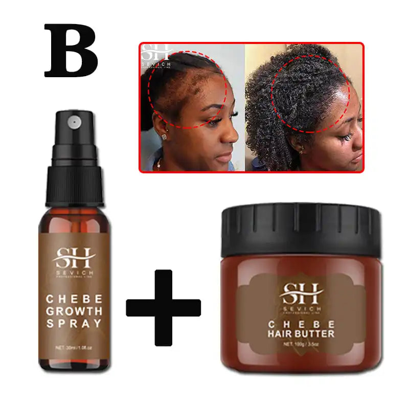 Sevich Chebe Hair Loss Treatment Spray Traction Alopecia Chebe Powder Essential Oil Africa Crazy Hair Growth Products Hair Care