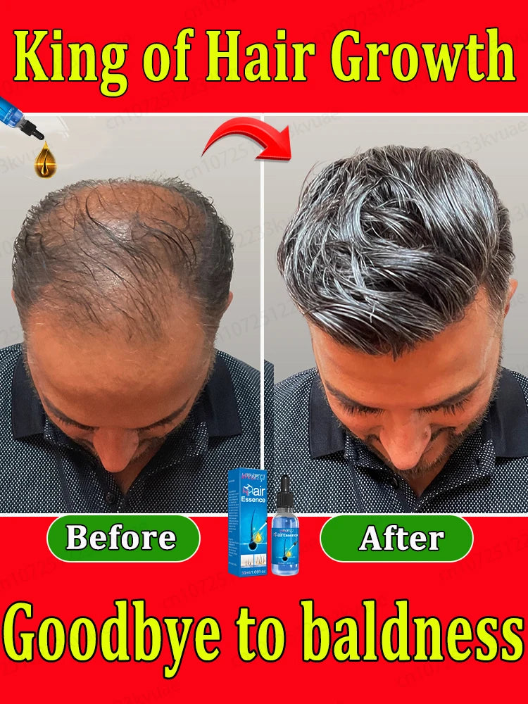 The most effective hair growth essential oil in 2024. Experts authoritatively certified,effective in repairing baldness and hair