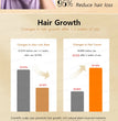 Hair growth essential oil, effectively repair baldness and hair loss, new hair growth