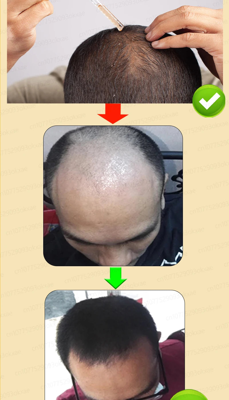 Hair growth essential oil, effectively repair baldness and hair loss, new hair growth