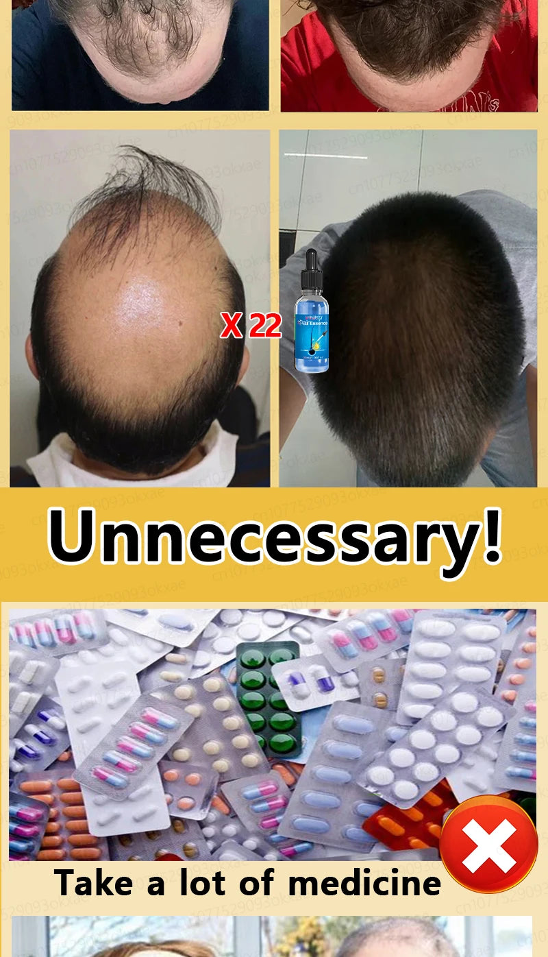 Hair growth essential oil, effectively repair baldness and hair loss, new hair growth