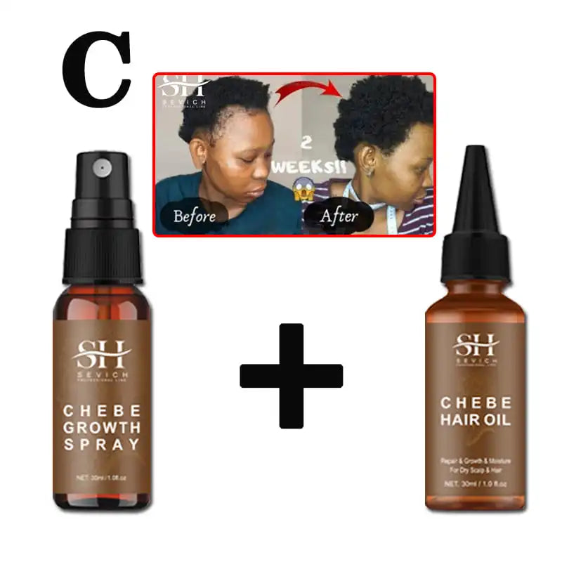 Sevich Chebe Hair Loss Treatment Spray Traction Alopecia Chebe Powder Essential Oil Africa Crazy Hair Growth Products Hair Care