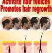 Hair growth essential oil, effectively repair baldness and hair loss, new hair growth