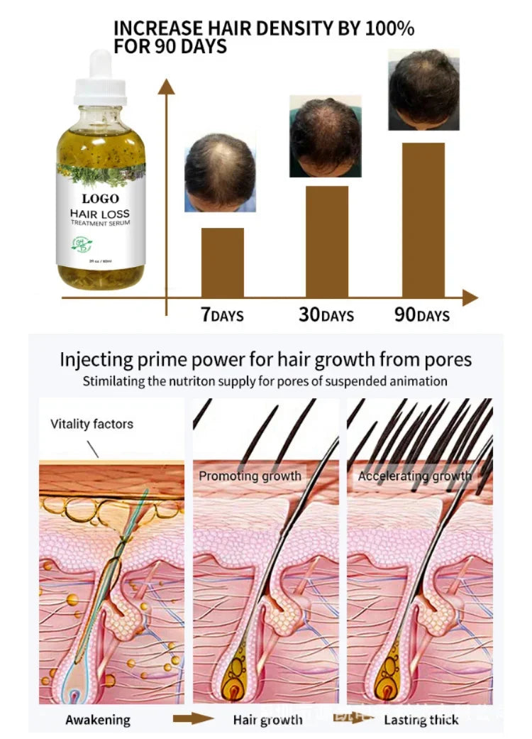 Rosemary Hair Growth Serum Anti Hair Loss Prevent Baldness Hair Care Essential Oil Scalp Treatment Beauty Health Care Men Women