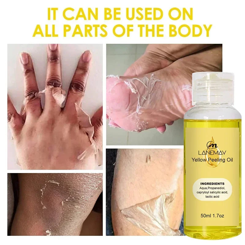 Yellow Peeling Oil Exfoliating Dead Skin Serum Care Dark Skin Bleaching Remove Knee Arm Legs Melanin Body Brighten Scrub Whiten