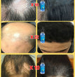 Hair growth essential oil, effectively repair baldness and hair loss, new hair growth