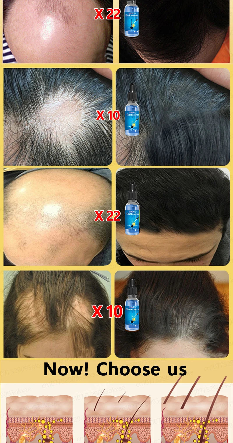 Hair growth essential oil, effectively repair baldness and hair loss, new hair growth