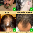 Hair growth essential oil, effectively repair baldness and hair loss, new hair growth