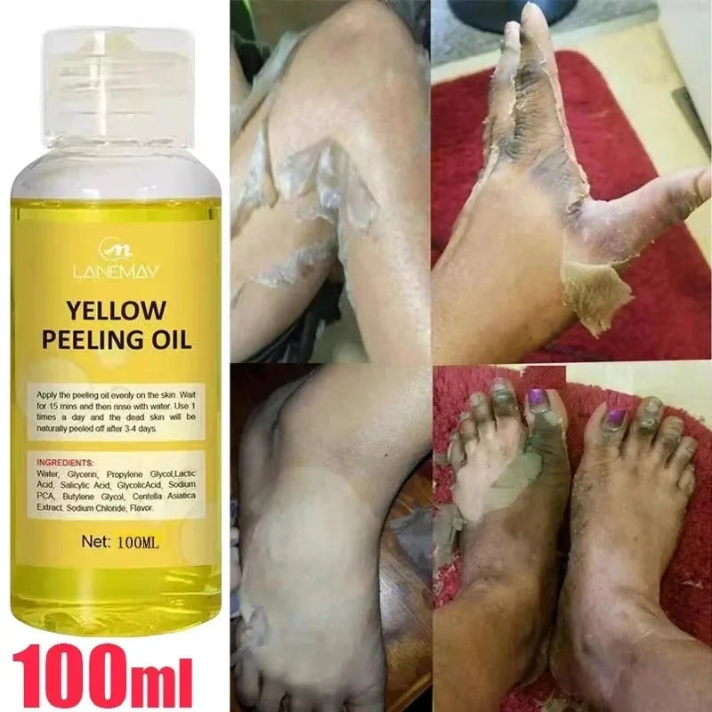 Yellow Peeling Oil Exfoliating Dead Skin Serum Care Dark Skin Bleaching Remove Knee Arm Legs Melanin Body Brighten Scrub Whiten