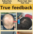 Hair growth essential oil, effectively repair baldness and hair loss, new hair growth