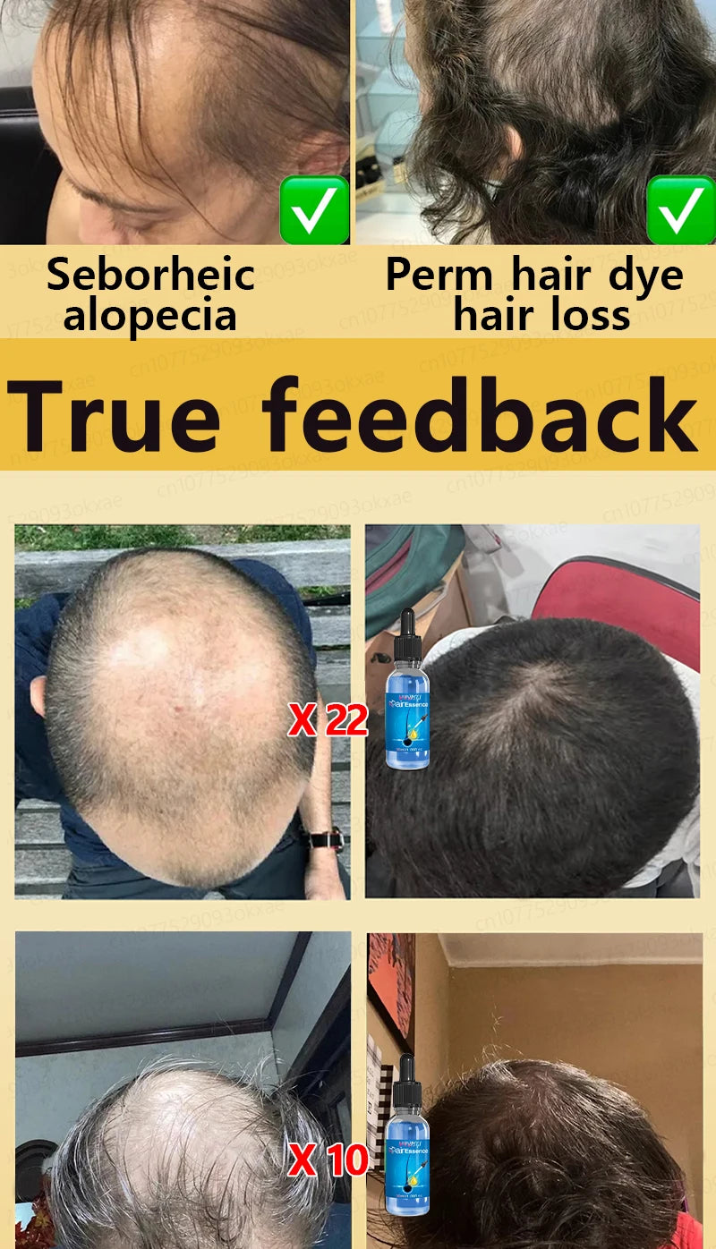 Hair growth essential oil, effectively repair baldness and hair loss, new hair growth