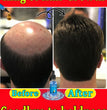 Hair growth essential oil, effectively repair baldness and hair loss, new hair growth