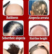 Hair growth essential oil, effectively repair baldness and hair loss, new hair growth