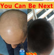 Hair growth essential oil, effectively repair baldness and hair loss, new hair growth